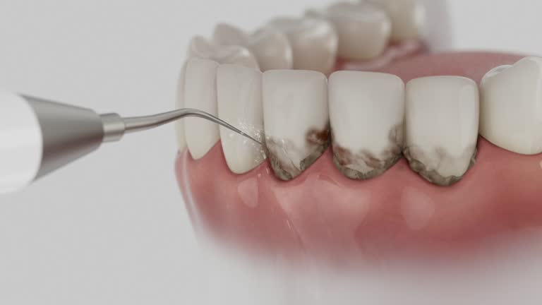 Trusted Tooth Extraction service in Brimfield, OH - Dentist Open Now